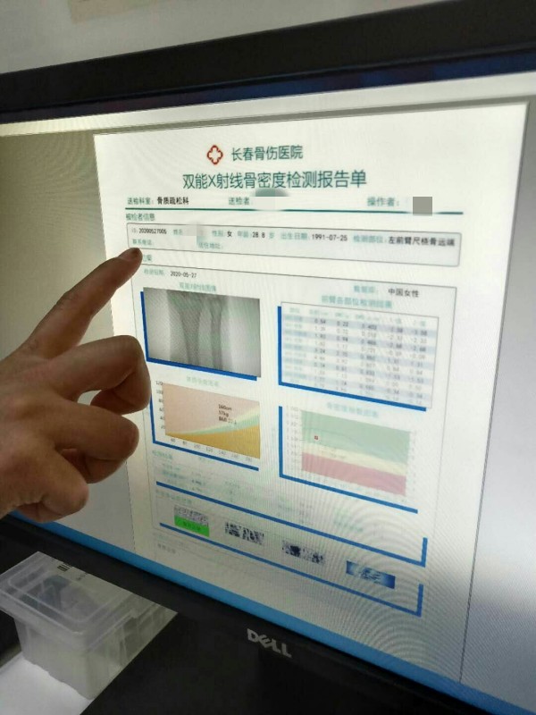 品源雙能X射線骨密度儀落戶吉林省長春骨傷醫(yī)院，助力骨松診療