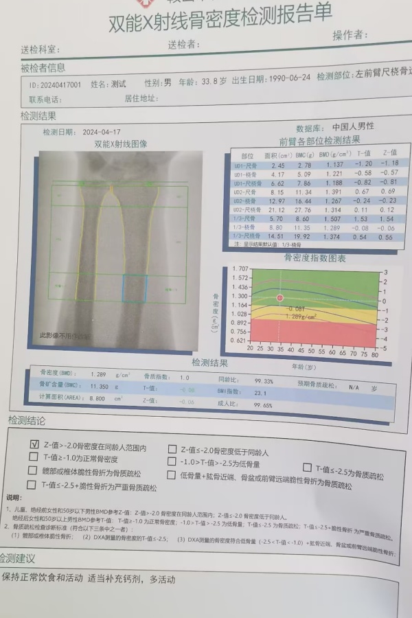 雙能X射線骨密度儀：準(zhǔn)確測(cè)量骨密度，助力骨質(zhì)疏松防治，守護(hù)骨骼健康